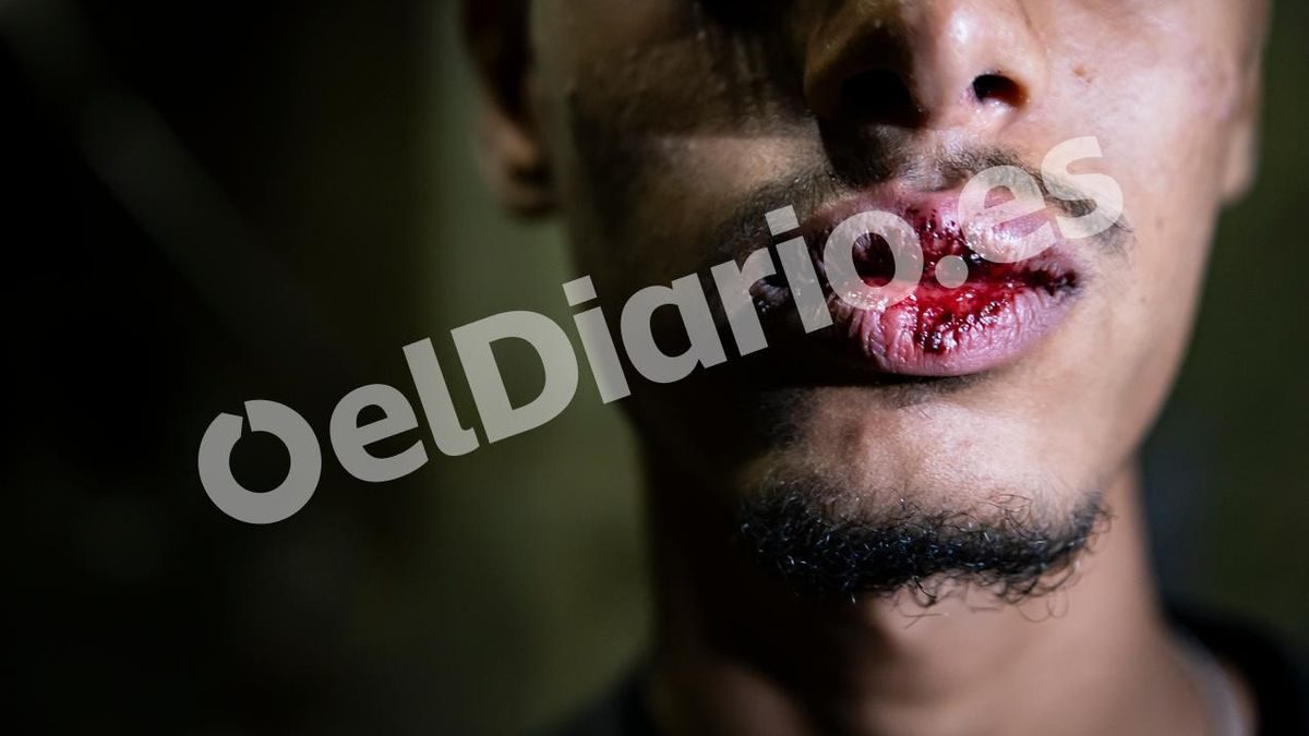 FOTOS | Las agresiones por las que los migrantes de Ceuta denuncian a militares