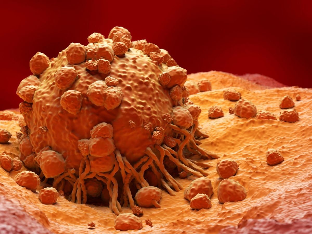 Cancer : comment la tumeur berne le système immunitaire