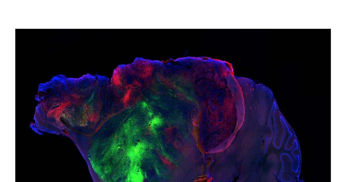 Científicos injertan neuronas humanas en ratones con medio cerebro y recuperan sus capacidades