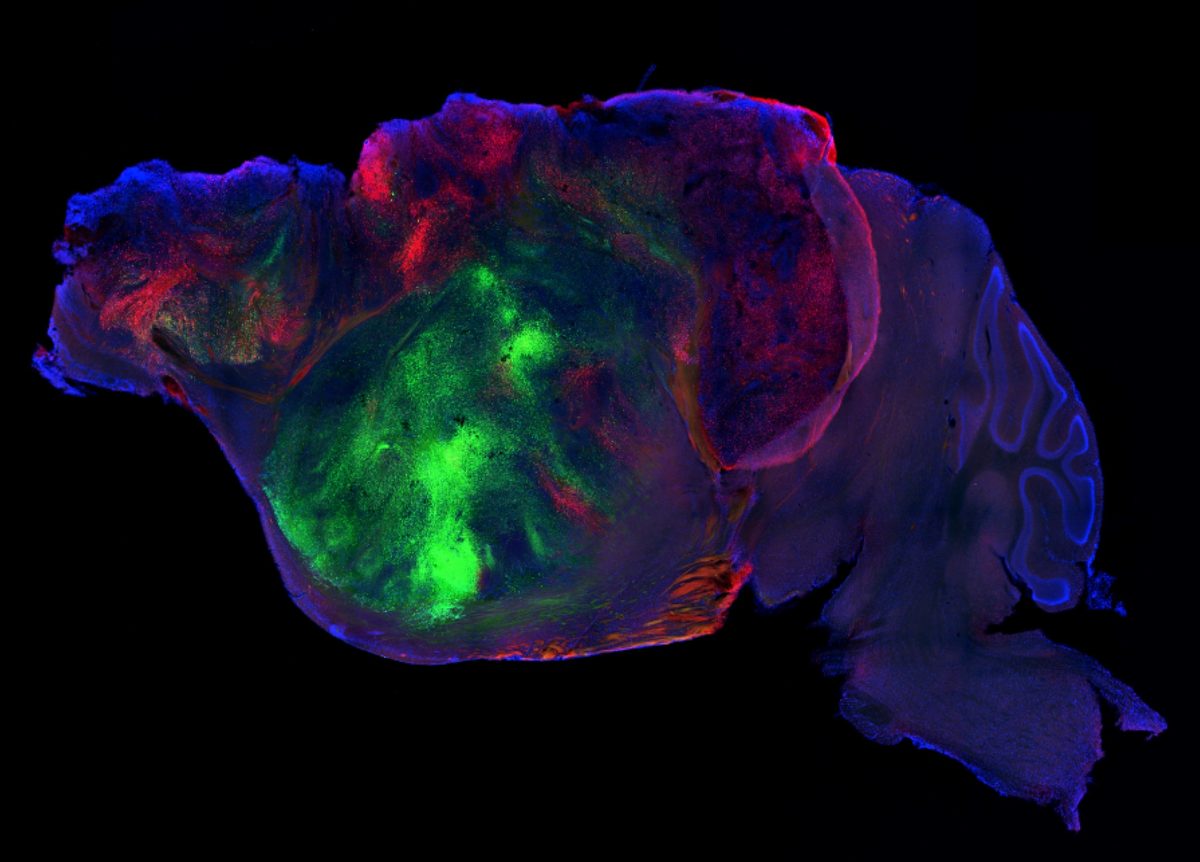Ratones con millones de neuronas humanas en su cerebro acercan la respuesta a enfermedades mentales