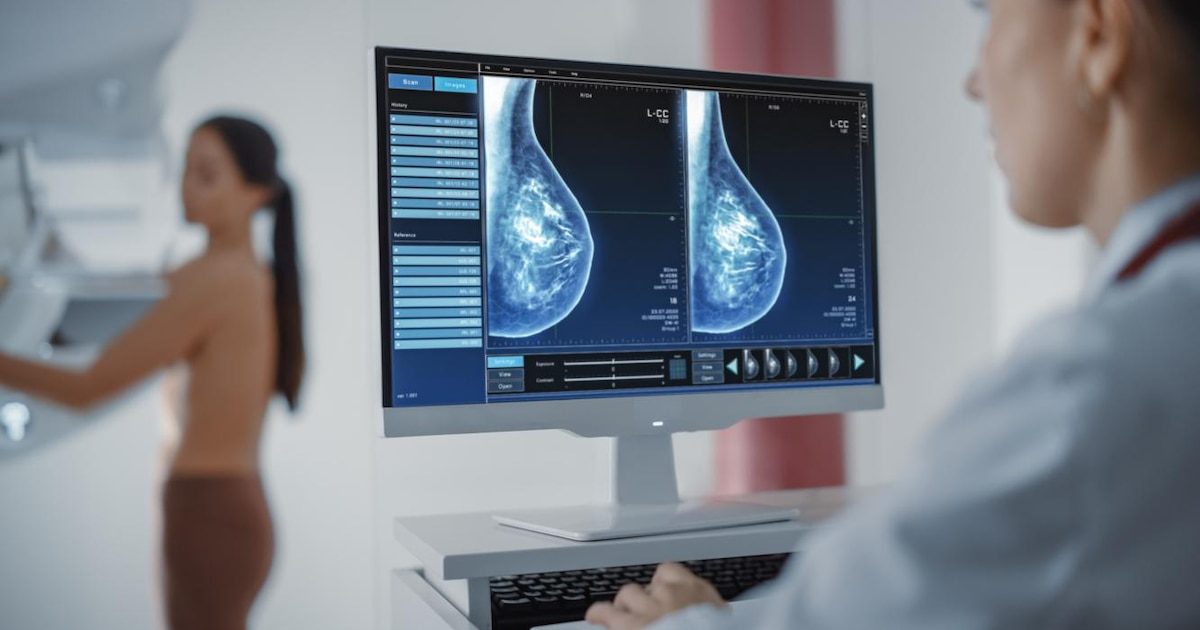 Les signaux d'alerte du cancer du sein sont encore trop peu connus : voici les réflexes à adopter