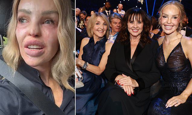 Katie Piper is praised as 'beautiful inside and out' as she fights back tears while revealing the vile abuse she receiv…