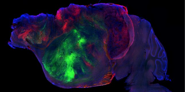 Des cellules cérébrales humaines implantées dans le cerveau de souris