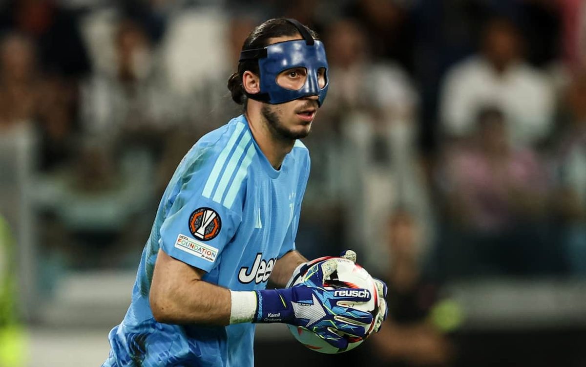 Chiamatelo Gra-Batman: ecco perché il portiere della Juventus indossa una maschera. VIDEO