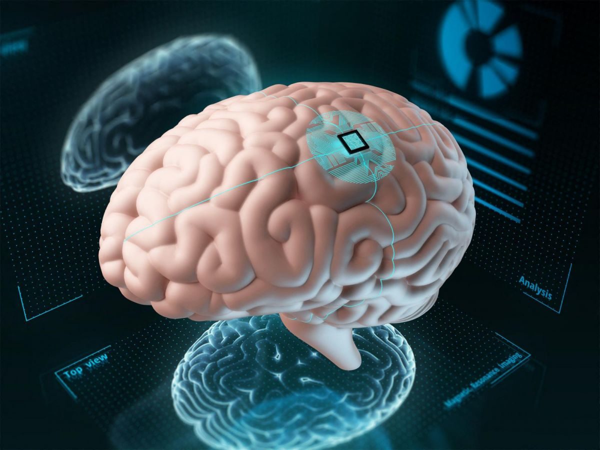Un implant cérébral parvient à décoder la parole et le mouvement des personnes paralysées