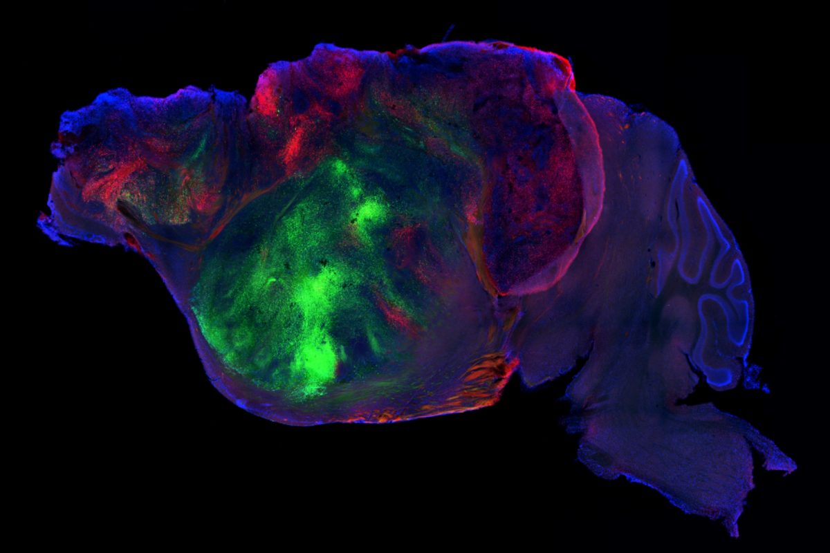 Scientists Created Mice With Half-Human Brains. The Hybrid Animals Could Revolutionize Our Understanding of Neurologica…