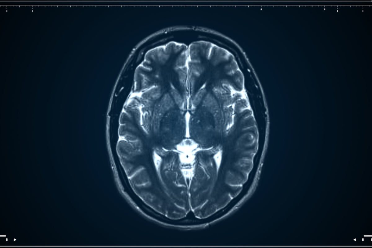 Human brain is actually two separate organs, scientists find