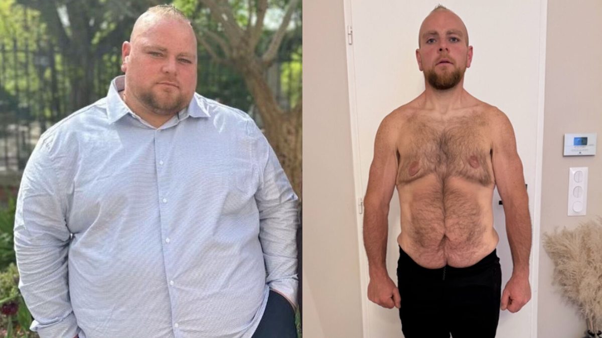 Il perd 100 kilos en 1 an : « C'est le jackpot ! »