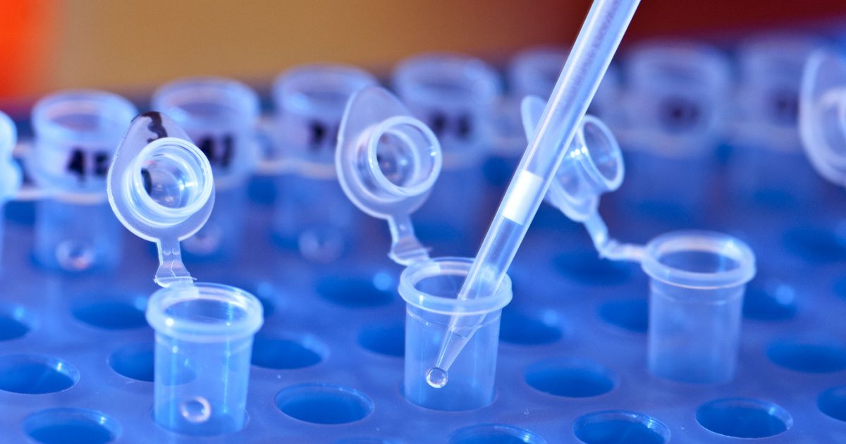 Anthropic slår alarm: Claude kan være brugt til biologiske våben