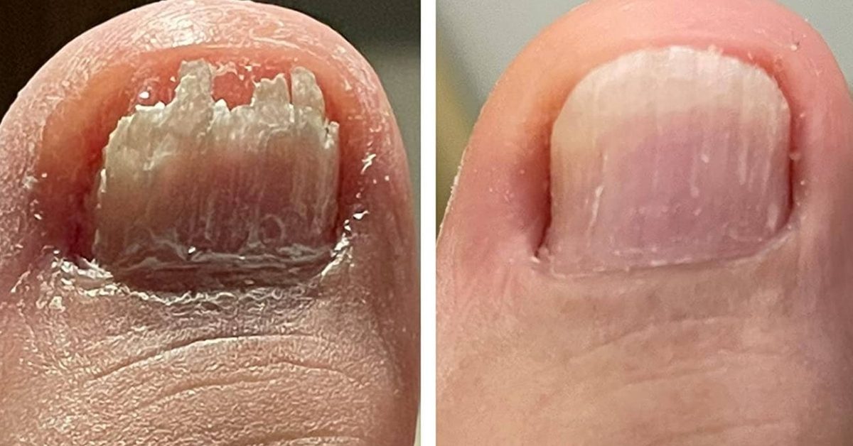 27 Body Care Products With Before And After Pics That’ll Give You A Visceral Reaction