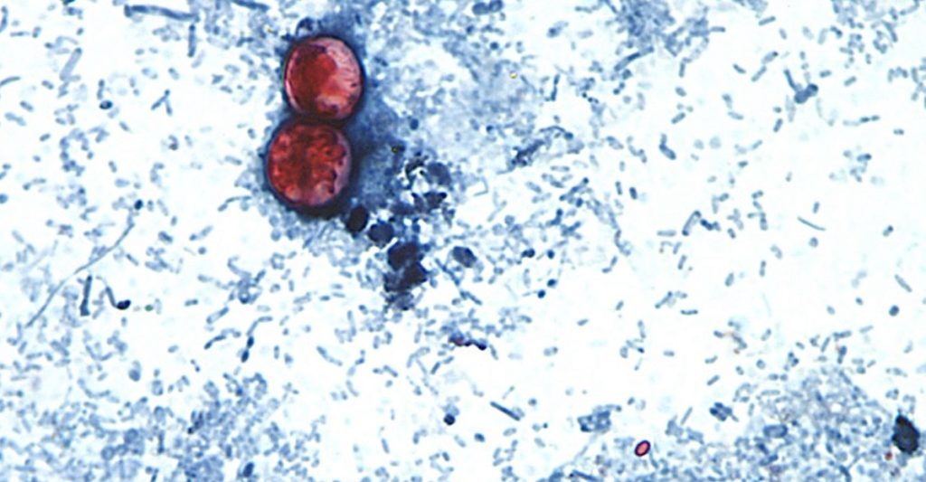 U.S. officials declare an end to record-setting cyclospora outbreak, but its origin is still unknown