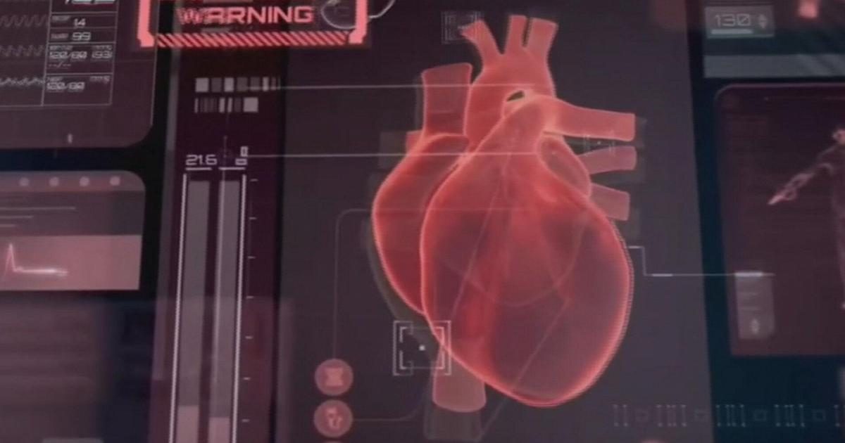 Superperizia: "Un cuore artificiale avrebbe potuto salvare Domenico, se trapiantato entro 72 ore"