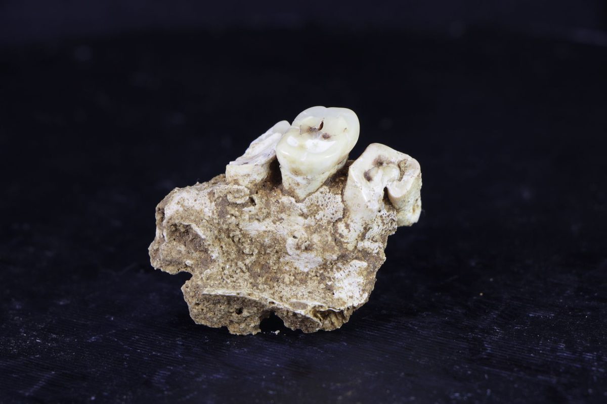 Archaeologists Discover the World's Oldest Evidence of Habitual Drug Use in the Teeth of a Hunter-Gatherer Who Lived Up…