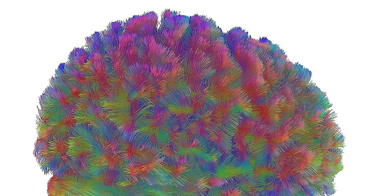 El cerebro no termina de madurar hasta los 24 años