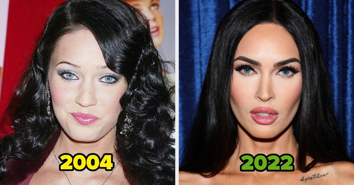 20 Famous People Who Got Unapologetically Candid About Their Plastic Surgery