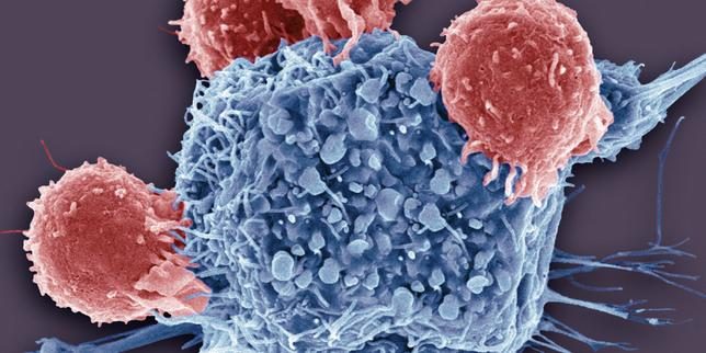 Une nouvelle arme des cellules cancéreuses découverte : l’émission d’un antioxydant pour affaiblir les cellules immunit…