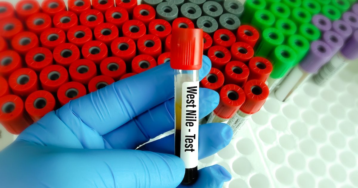 Cinq cas humains de virus du Nil suspectés en Flandre : "Il est sage de s’attendre à ce que des cas soient observés ail…