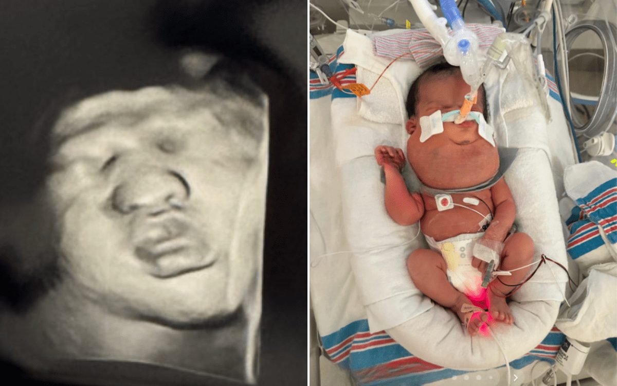 Pregnant Woman Goes for Scan, Then Comes Terrifying Two-Word Diagnosis
