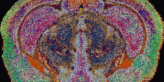 Dans le cerveau, il y a beaucoup de gras : la preuve par l’image