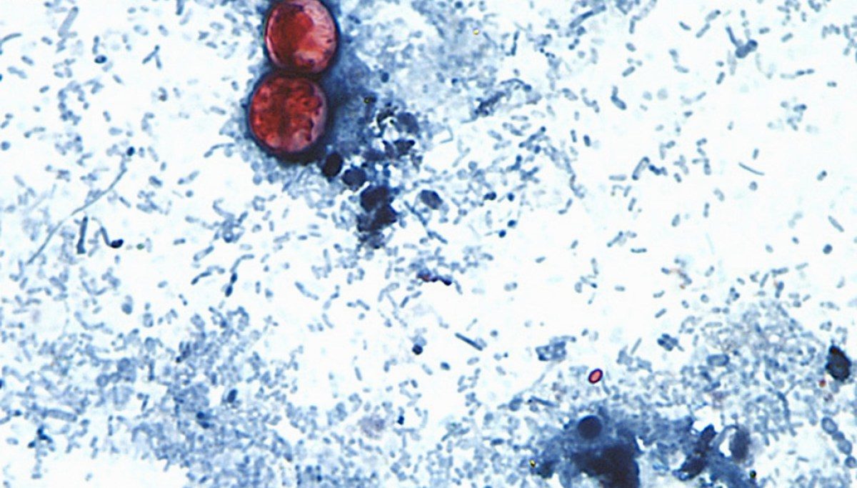 CDC declares record-breaking cyclosporiasis outbreak over after almost 13,000 cases