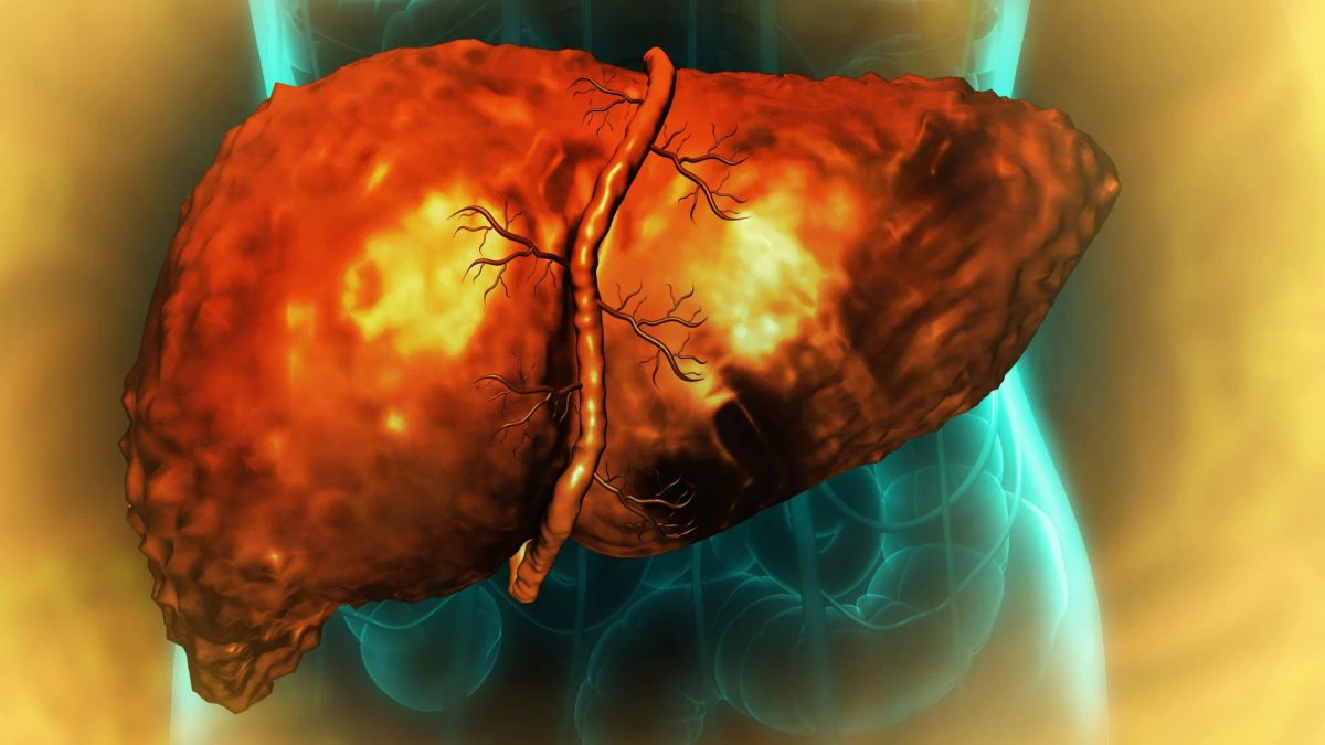 Common dry-cleaning chemical linked to triple the risk of liver scarring