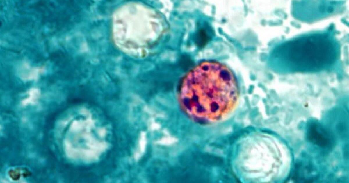 Cyclosporiasis outbreak that sickened tens of thousands officially over, CDC says