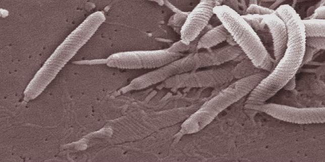 Un nouveau cancer sur huit est causé par des infections, selon une étude du CIRC