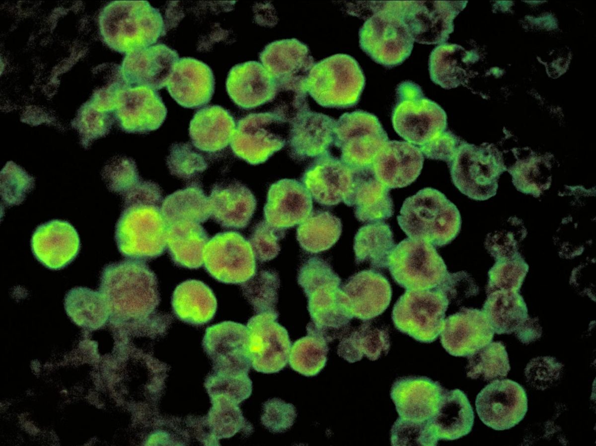 La claustrophilie des amibes "mangeuses de cerveau"