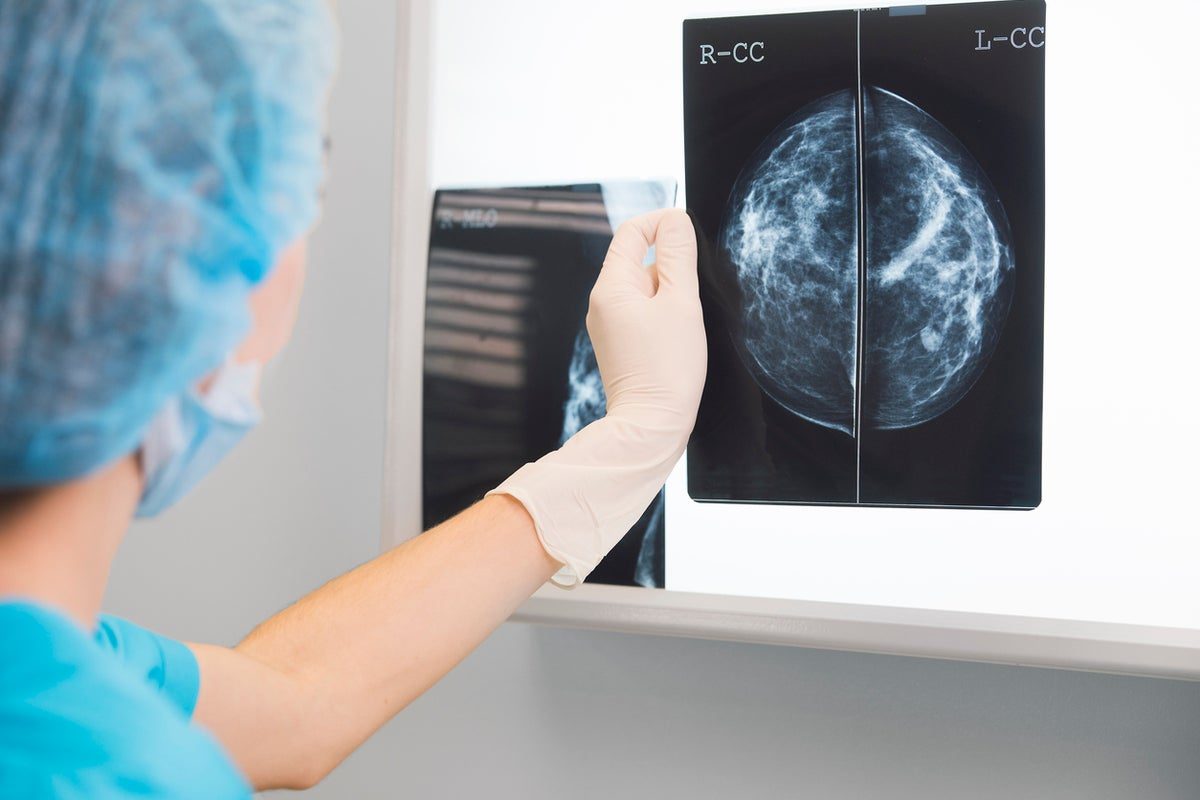Major breakthrough in treatment for ultra-rare 'second skeleton' disease