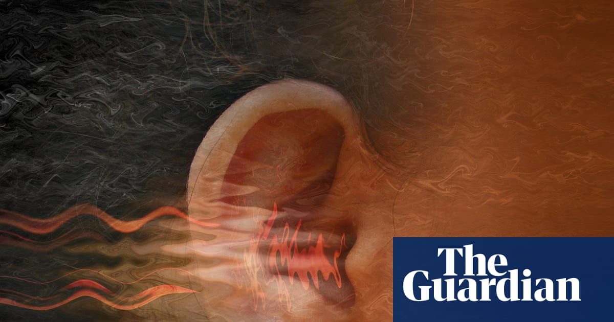 Living with tinnitus can be distressing. So what can you do about it?