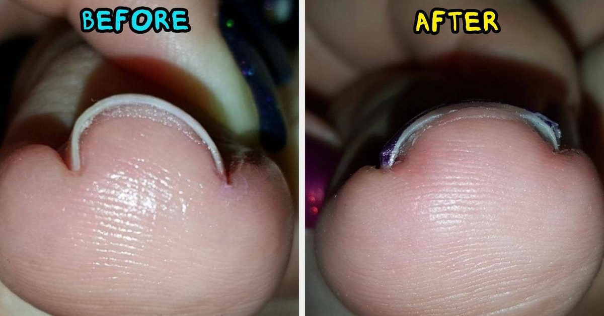 37 Products If You’ve Had *Enough* Of Ingrown Hairs, Stinky Feet, And "Buttne"