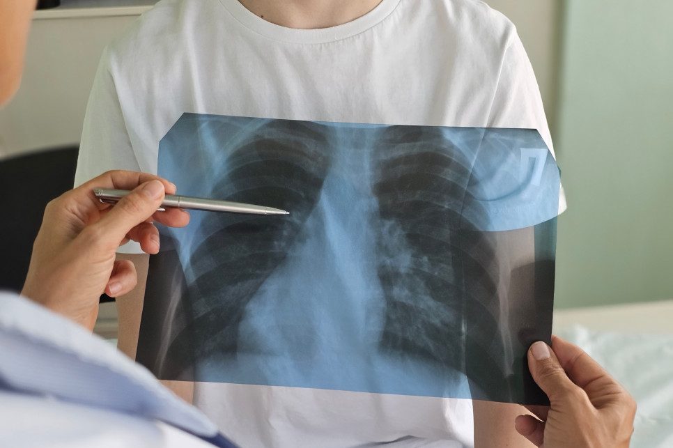Ukryte zagrożenie w klasie. Uderza w płuca uczniów