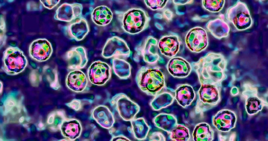 Coroner releases details on 2 infant deaths in Pennsylvania measles outbreak