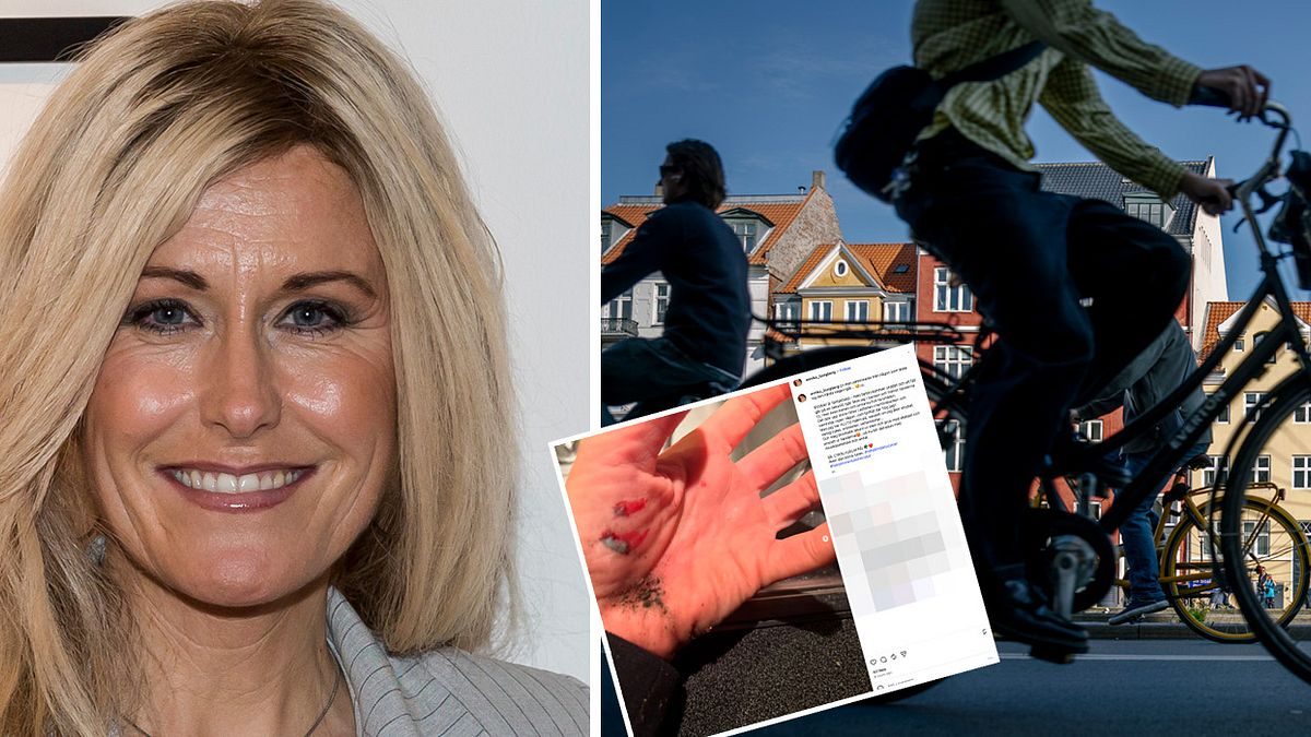 Rednex-Annika i elsparkcykelolycka: ”Rann sårvätska och blödde”