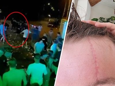 Siem (19) stond rustig een biertje te drinken, tot een autokrik zijn voorhoofd raakte: ‘Vanaf toen weet ik niets meer’