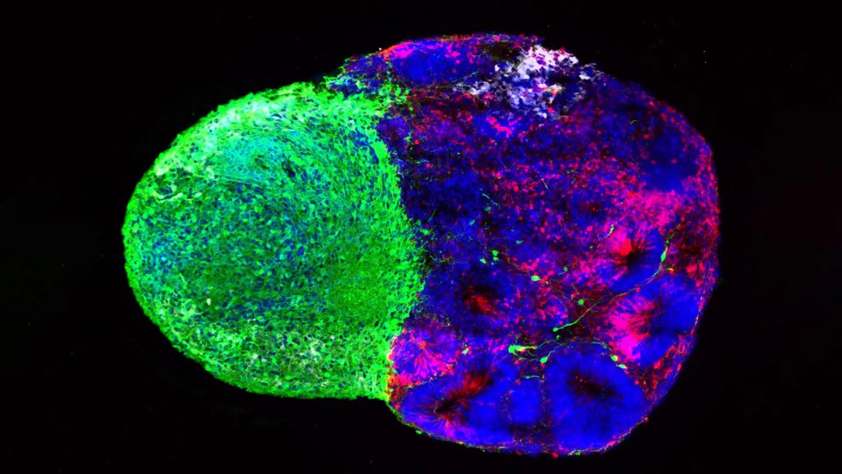 Scientists reveal the hidden instructions that build the human brain