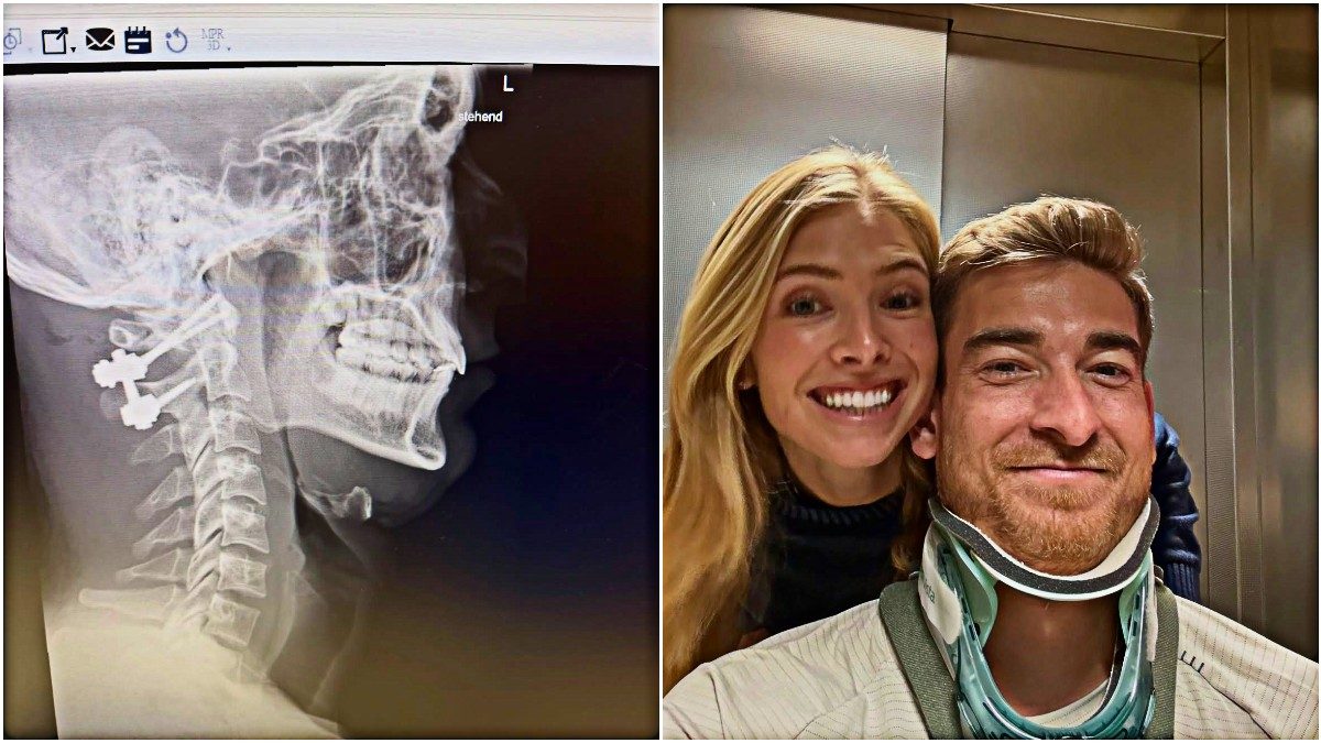 “Ho rischiato di non camminare più, non riuscivo a muovere il collo. Ora ho quattro viti”: così Klinsmann jr