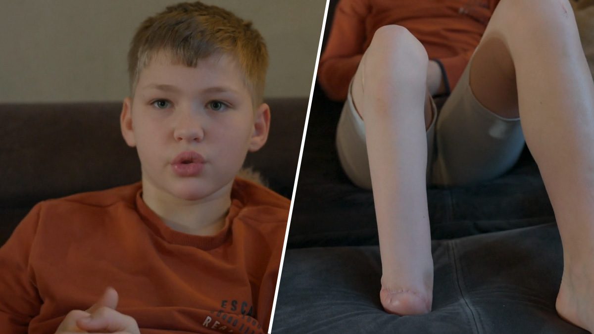 Sven de Lange (12) uit Een huis vol blijft positief na voetamputatie: 'Elk nadeel heeft zijn voordeel'