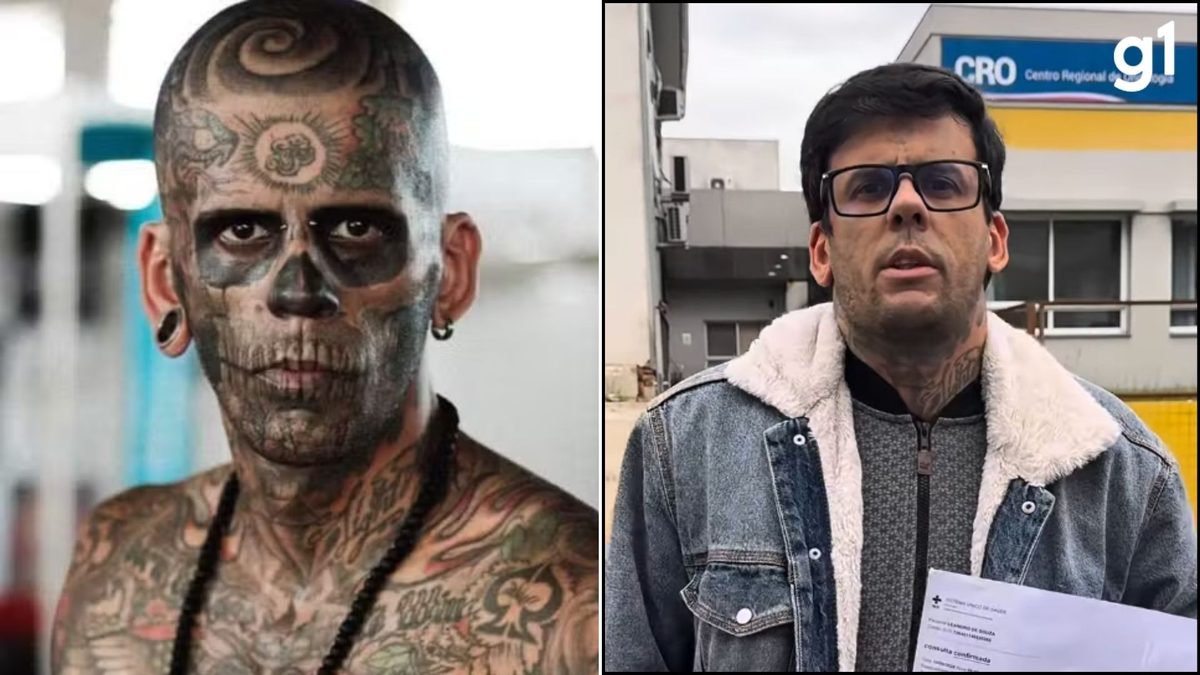 Cirurgia para retirada de tumor na bexiga do 'homem mais tatuado do Brasil' definirá se nódulo é benigno ou maligno; en…