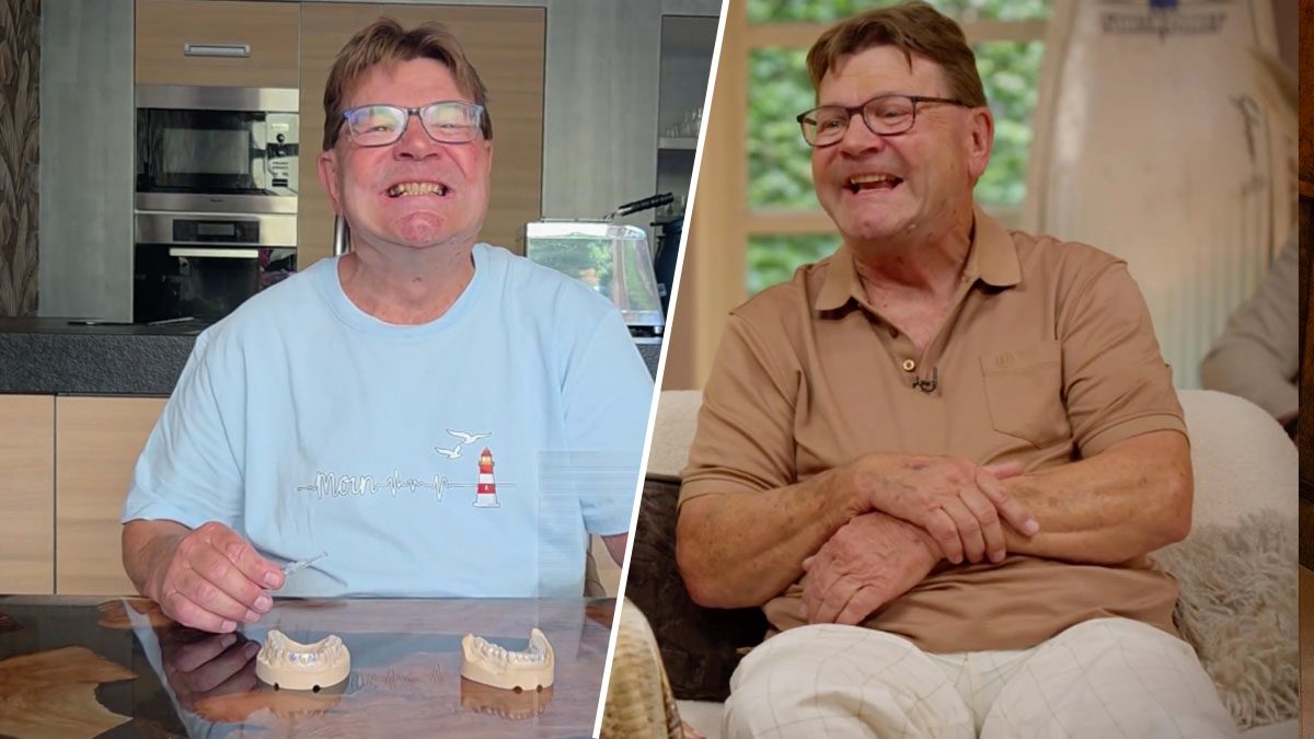 Arie ging na B&B Vol Liefde-opnames naar de tandarts voor wittere tanden