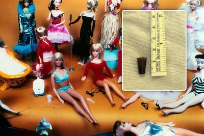 Vrouw (59) die maar niet van longontstekingen afraakt blijkt al 51 jaar Barbie-bekertje in haar longen te hebben