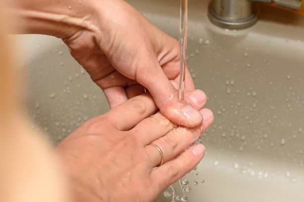 Dr Amir Khan says running cold water on a burn is 'wrong' - what to do instead