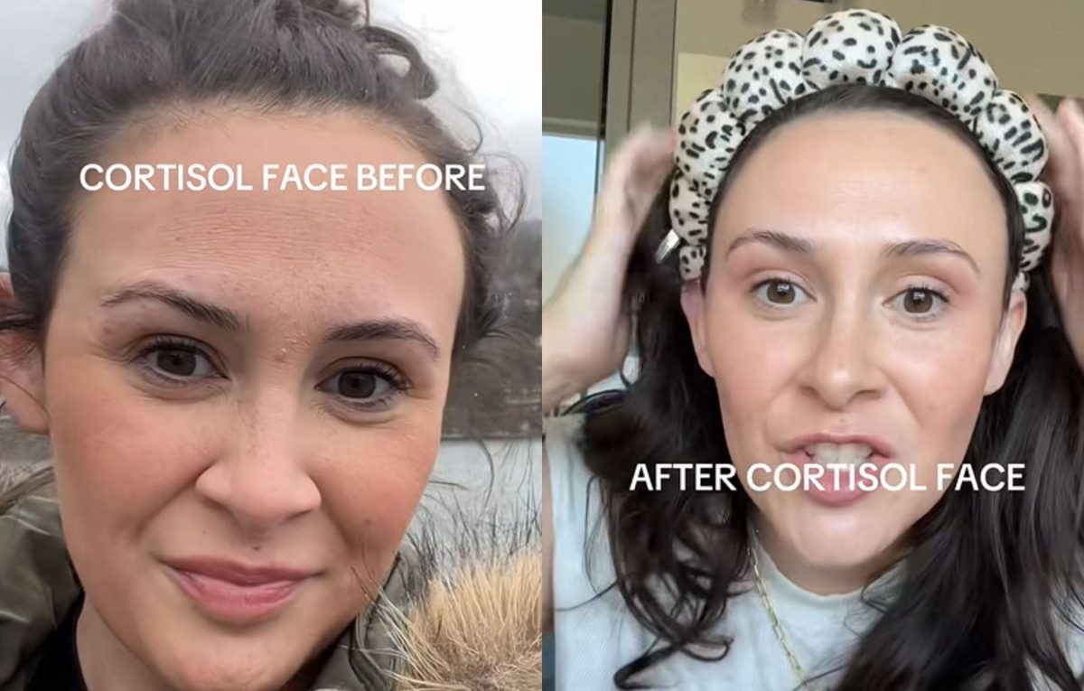 Le « cortisol face » est-il une arnaque des réseaux sociaux ?