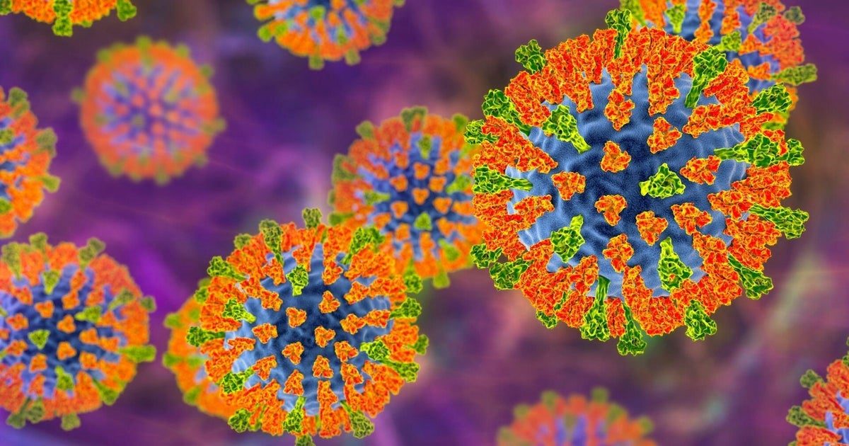 Pennsylvania woman dies of measles complications, Jefferson County Coroner reports
