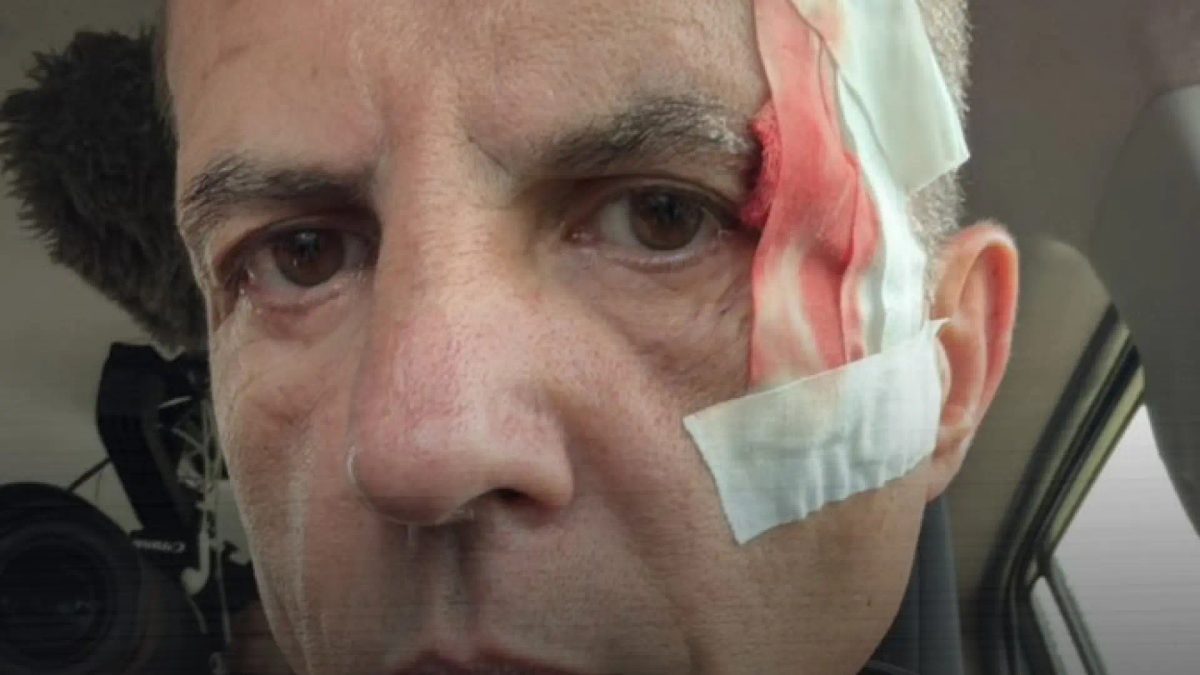 Cristóbal Soria sufre un accidente durante la grabación de 'Planeta Calleja' en Costa Rica