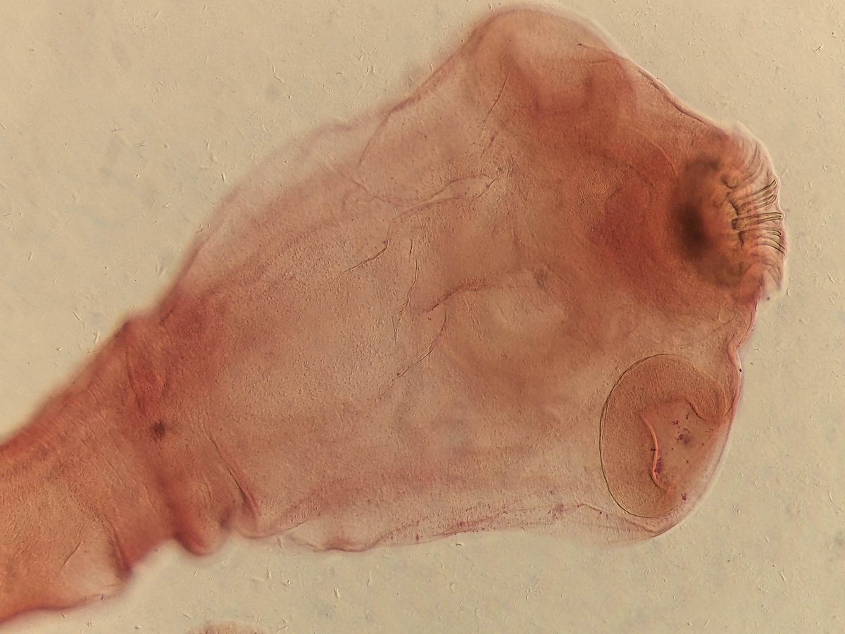 What caused this woman’s hallucinations? Doctors reveal an infestation of brain worms