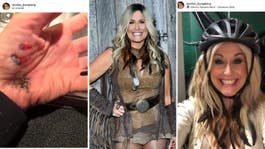 Rednex-artistens vädjan efter olyckan på elcykel